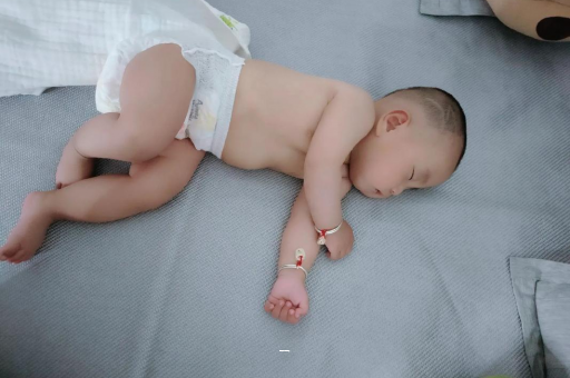 澳门宝宝脸上有白色斑块 澳门宝宝脸上有白色斑块